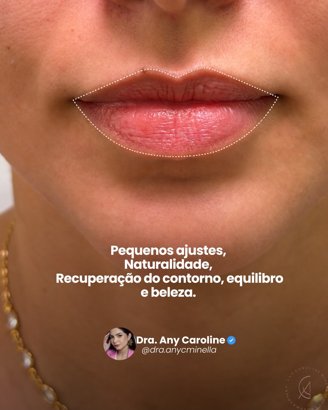 O olhar para os detalhes. Registro original publicado no Instagram da Dra. Any